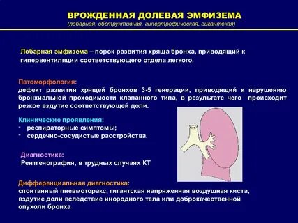 Врожденная долевая эмфизема