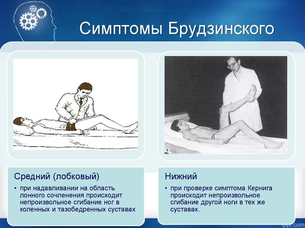 Последствия менингита у взрослых. Нижний менингеальный симптом Брудзинского. Симптомы менингита Кернига Брудзинского. Менингеальные симптомы Брудзинский. Верхний Нижний симптом Брудзинского верхний.