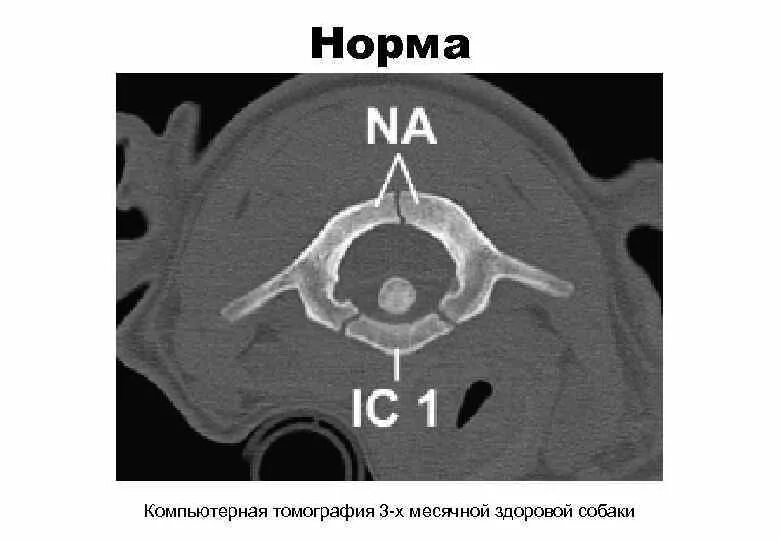 Показатели кт. Нормативы кт исследований. Расщепленный Атлант с1.