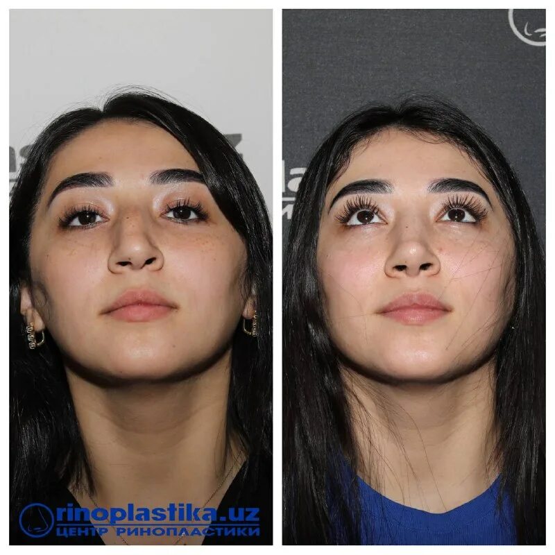 центр ринопластики