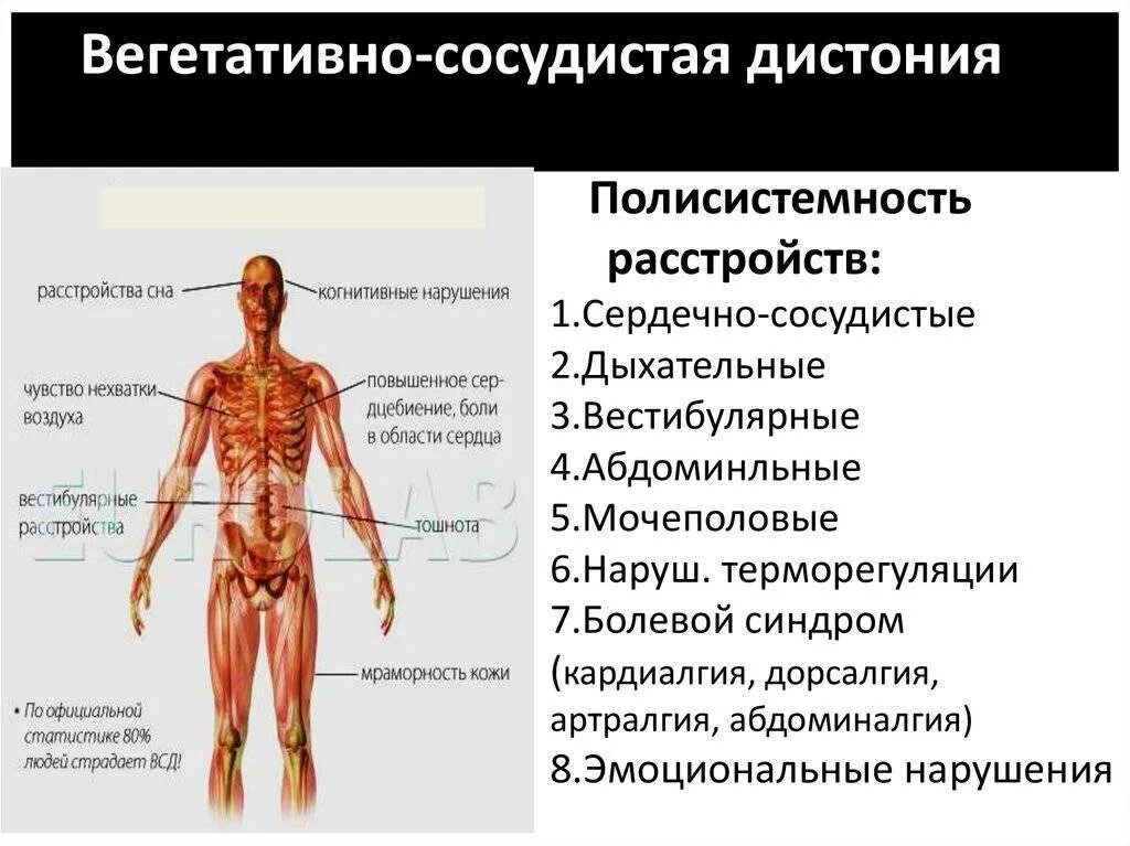 Берут ли с всд. Симптомы вегето-сосудистой дистонии. Вегето сосудистая дисфункция симптомы. Вегетососудистая димтония. Вегетососудистая дистантя.