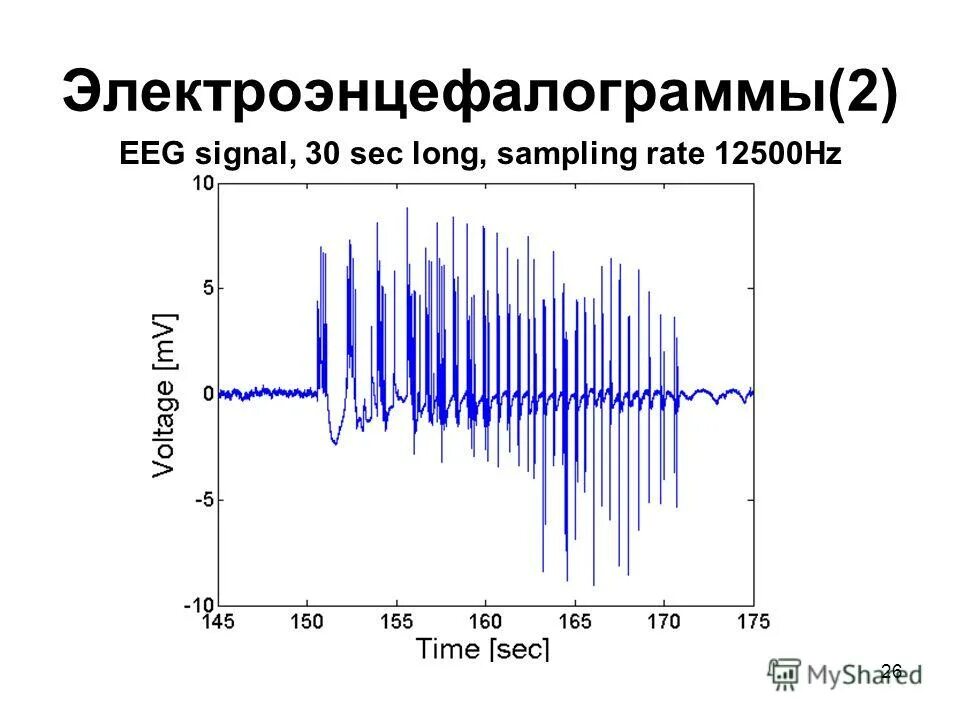 Ээг сигнал. Электроэнцефалограмма график. EEG Signal. Лампа для электроэнцефалограммы. Источники электроэнергии ЭЭГ.