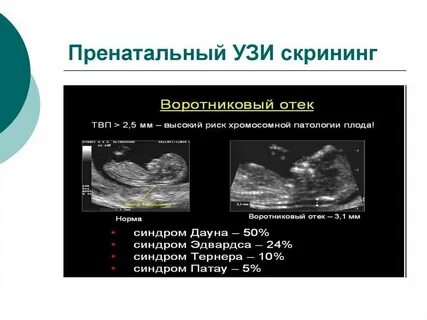 Увеличение толщины воротникового пространства