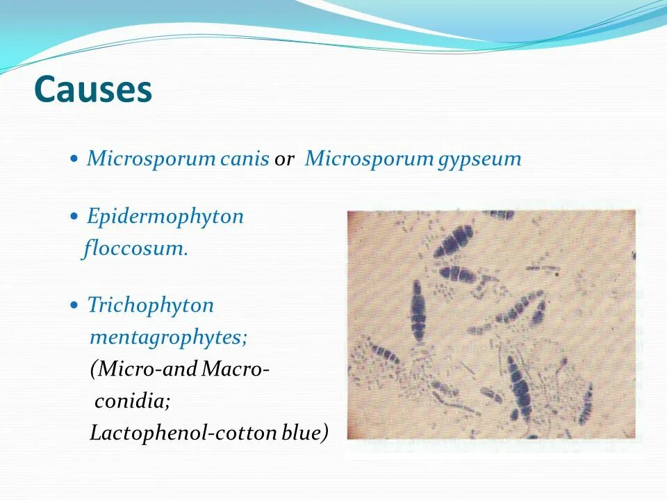 Микро особенность. Систематика микроспорум Канис. Microsporum canis систематика. Trichophyton gypseum. Epidermophyton floccosum систематика.