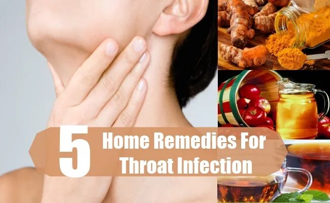 Throat 5. Treatment for sore throat. Spray for the throat.