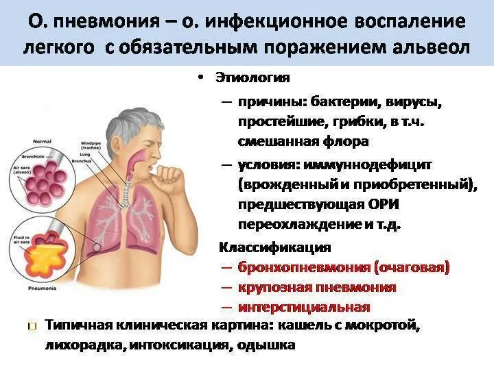 Пневмония это инфекционное заболевание. Инфекционная пневмония. Заразные заболевания легких