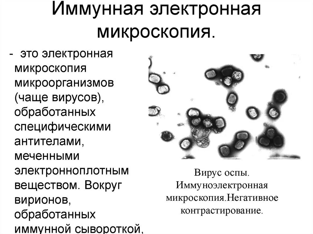 Метод микроскопии позволяющий изучать вирусы напрямую. Иммуноэлектронная микроскопия метод. иммуноэлектронная микроскопия микробиология. иммунная электронная микроскопия в иммунологии. электронная микроскопия.