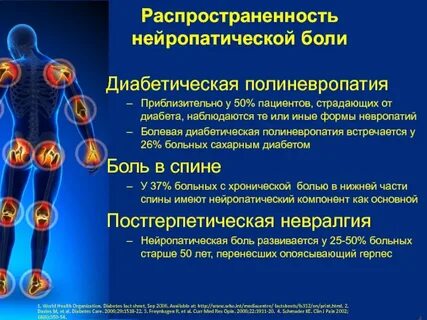 Боли диабетиков