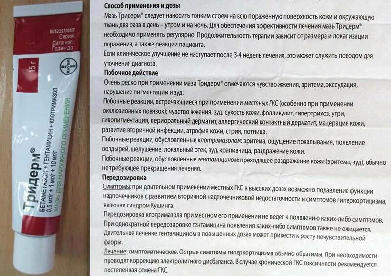 Тридерм мазь инструкция по применению аналоги. 3 дерм мазь. тридерм мазь для чего применяется. крем от псориаза тридерм. мазь противогрибковая тридерм.