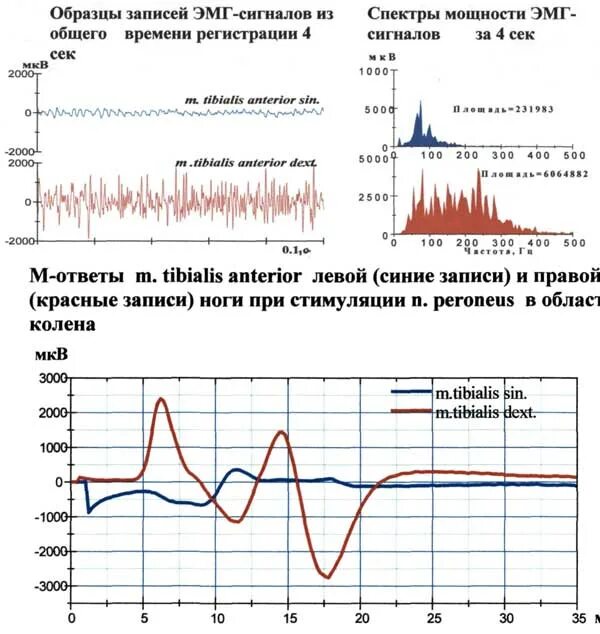 Состояние нервно мышечного аппарата оценивается по результатам. Состояние нервно мышечного аппарата оценивается по результатам