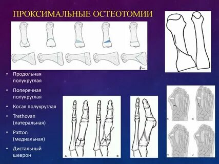 Проксимально