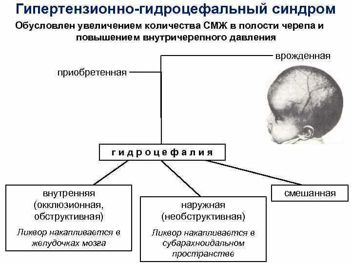 Внутриутробное недоразвитие головного мозга. Гидроцефалия Тип наследования. Гидроцефально-гипертензионный синдром. Обтурационная гидроцефалия Тип наследования. Врожденные патологии. Гидроцефалия..