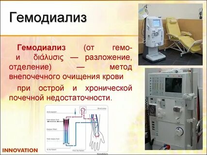 Механизм диализа