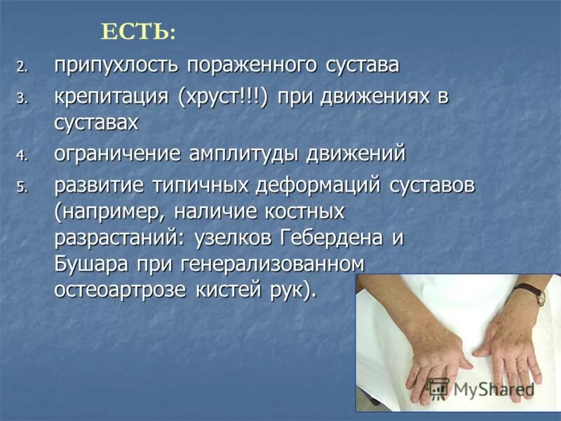 Крепитация при. Ограничение подвижности сустава. Крепитация при движении. Грубая крепитация в суставе характерна для. Крепитация.