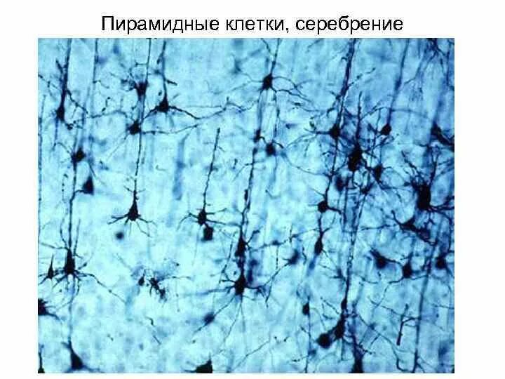 Клетки беца в коре полушарий большого мозга. Большие пирамидные клетки. Пирамидные нейроны коры больших полушарий. Клетка беца нейрофибриллы. Большой пирамидный нейрон полушария большого мозга гистология.