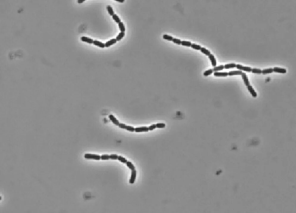 Rhamnosus gg. Lactobacillus rhamnosus под микроскопом. лактобацилус казей. lactobacillus rhamnosus gg (lgg®. lactobacillus casei под микроскопом.
