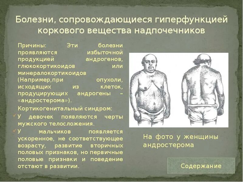 Нарушение работы надпочечников симптомы у женщин. Надпочечники и стресс. Заболевания надпочечнико. Механизмы развития симптомов при синдроме иценко кушинга. Гипофункция надпочечников признаки.