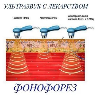 Ультразвук сколько