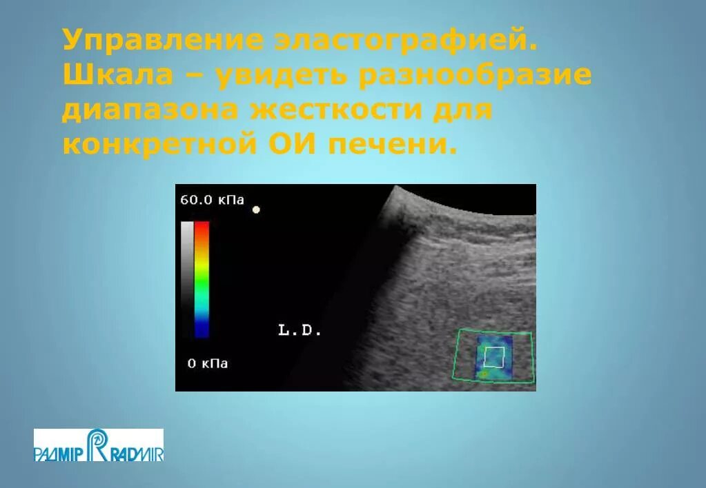 Эластометрия печени