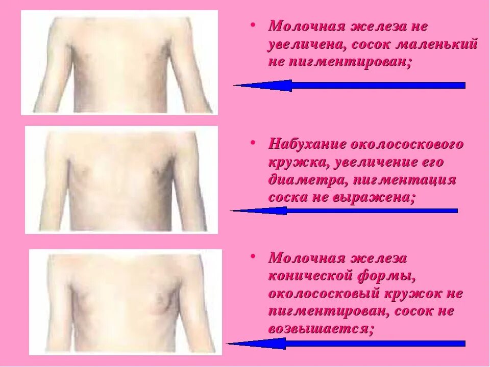 Рост желез. Развитие груди. молочные железы у подростков девочек. этапы роста груди.