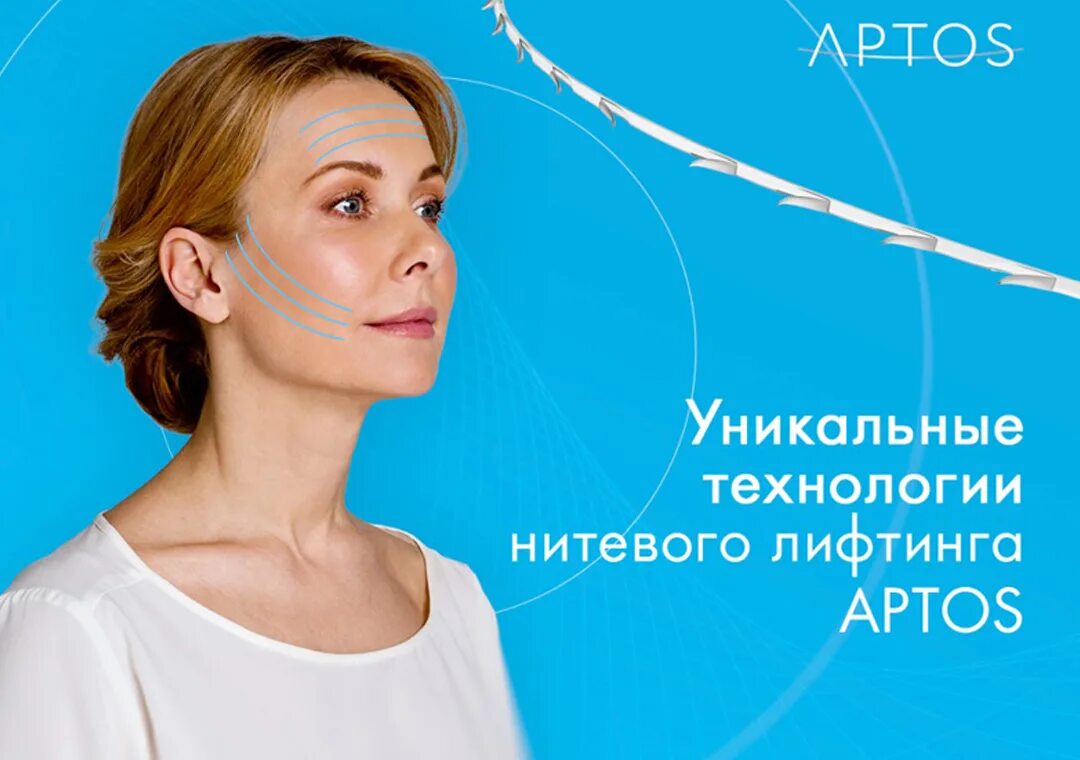 Нити Aptos. Нитевой лифтинг Aptos. Нити Аптос для подтяжки лица.