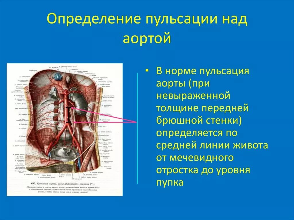 Почему сильно пульсирует в животе. Пульсация аорты в брюшной полости. Брюшная аорта пульсирует. Пульсация брюшной аорты причины. Брюшная аорта пульсирует причины.