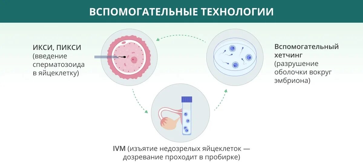 Экстракорпоральное оплодотворение схема. Журнал эко/ИКСИ - ЦЕНТРМАГ. Этапы протокола эко. Как делают эко.