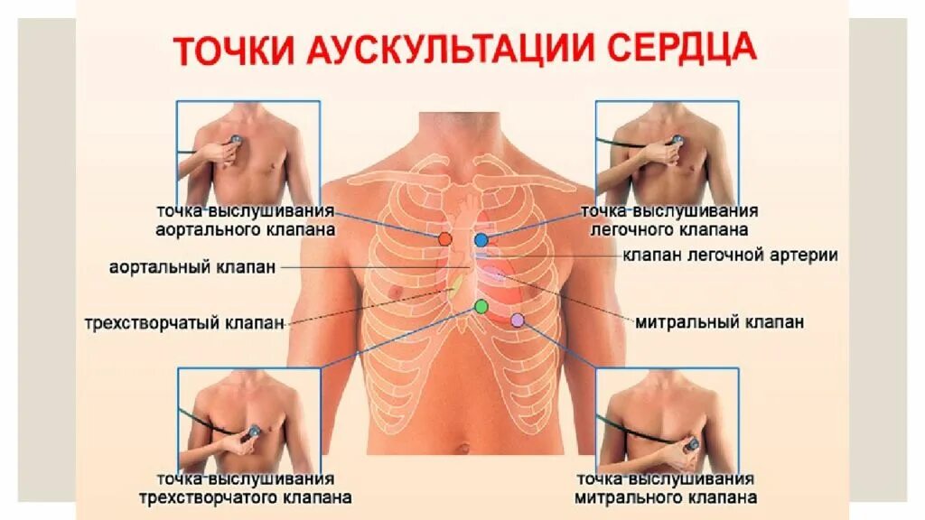 Аускультация сердца алгоритм. Точки прослушивания сердца. точки выслушивания тонов сердца. точки аускультации клапанов сердца. точки выслушивания клапанов.