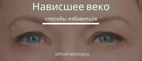 Нависающее верхнее веко как избавиться