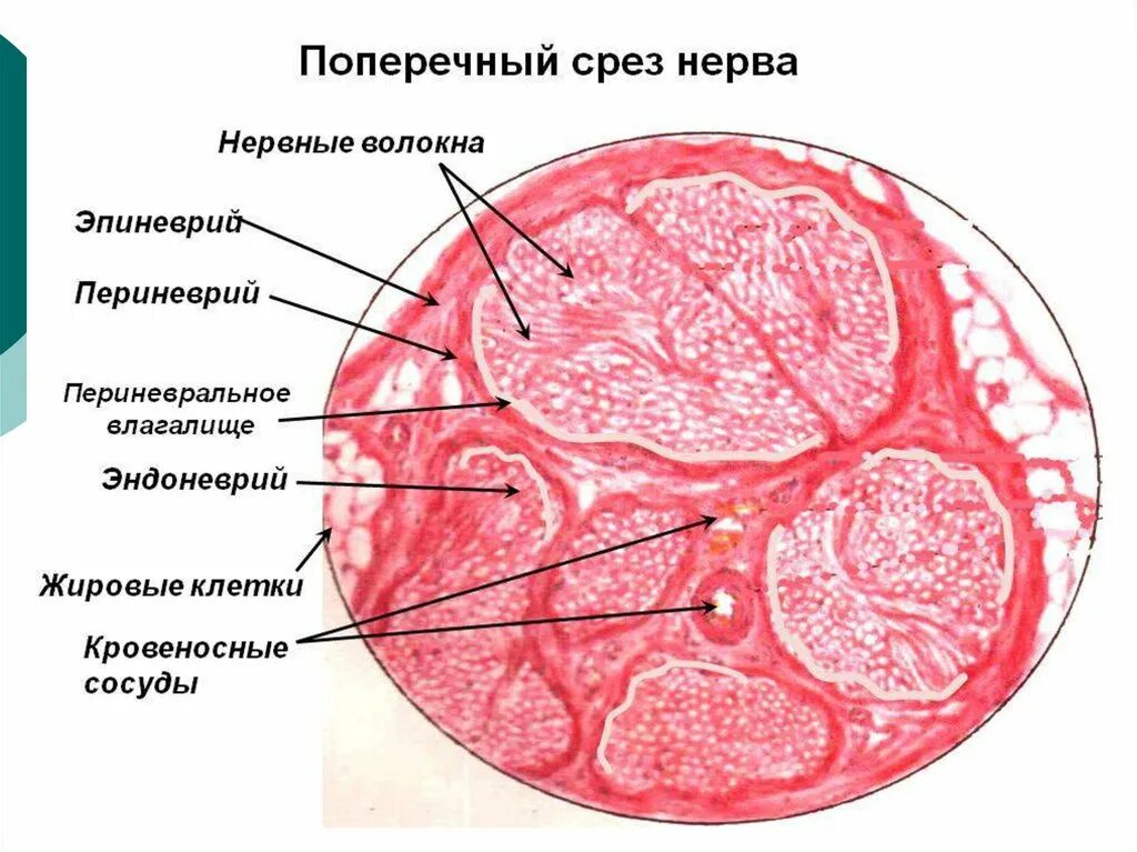 Нерв гистология. Поперечный срез периферического нерва. поперечный срез нерва гистология. поперечный срез нерва гистологический препарат. поперечный срез нерва гистология препарат.