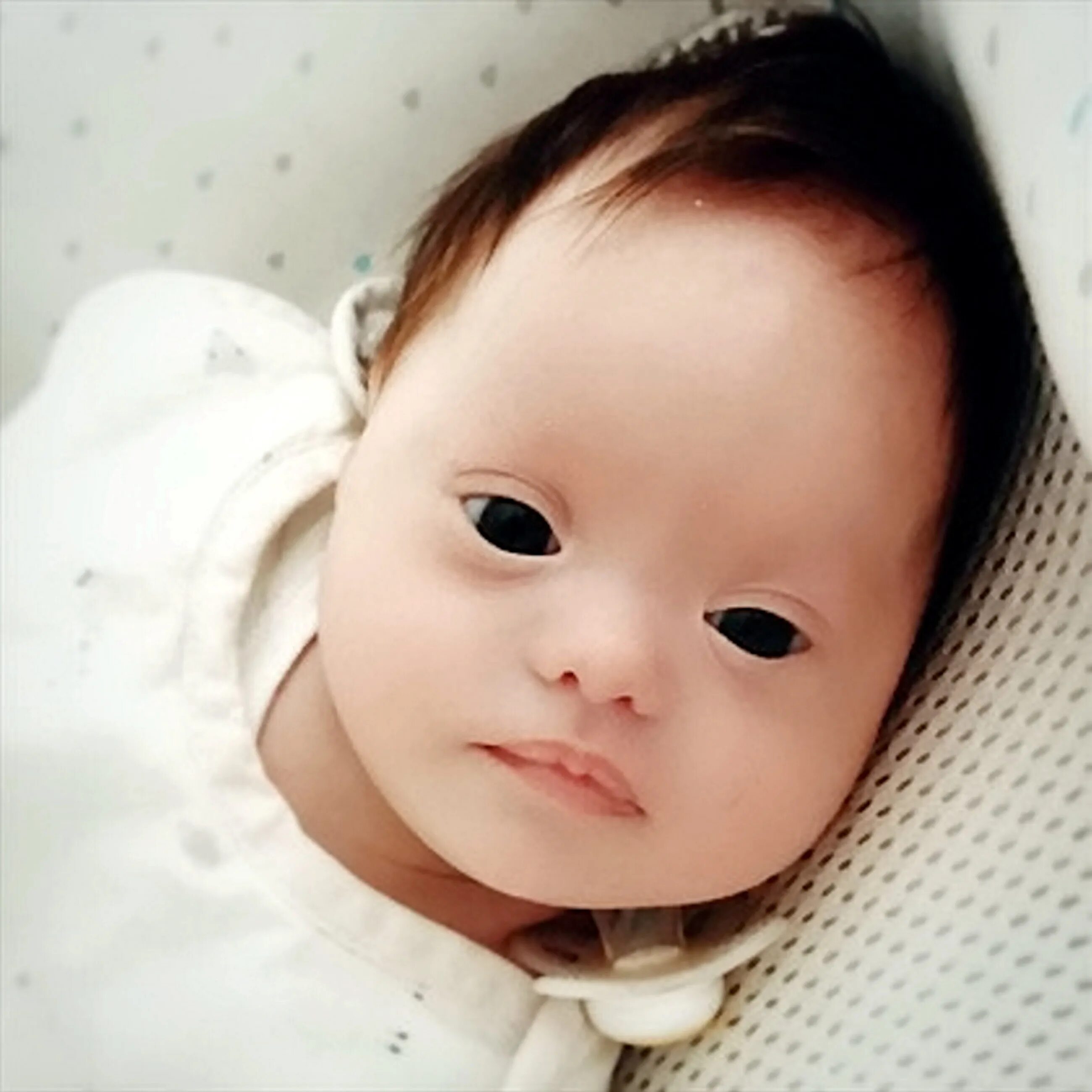 Младенцы с синдромом Дауна. Новорожденные с синдромомом Дауна. Новорожденные дети дауны. Родился какое лицо