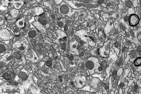 Transmission microscopy