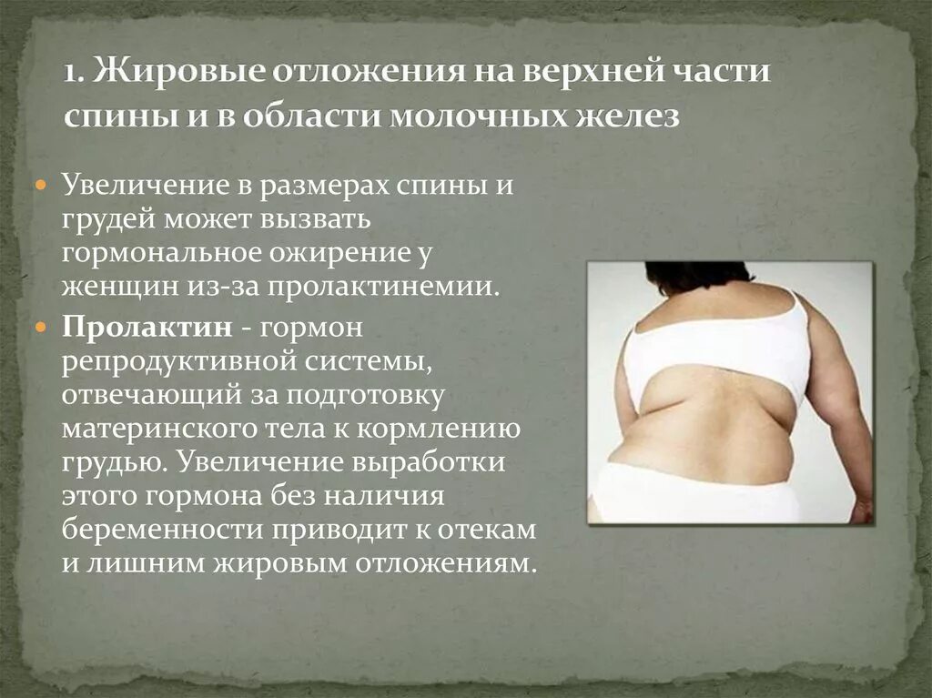 смешанное ожирение. ожирение гормональные сбои. ожирение гормональные сбои. ожирение. гармональные ожирение.