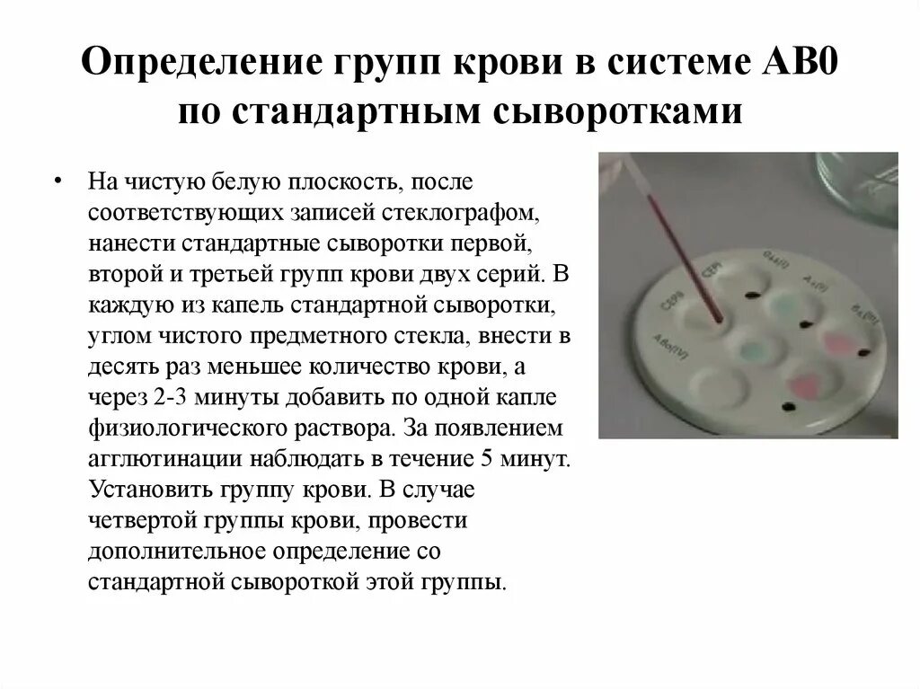 2 группа крови определение. Определение групп крови по стандартным сывороткам. Определение группы крови методом стандартных сывороток. Методика определения групп крови и их совместимость.. Определение группы крови крови по стандартным сывороткам.