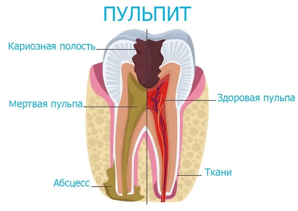Пульпа