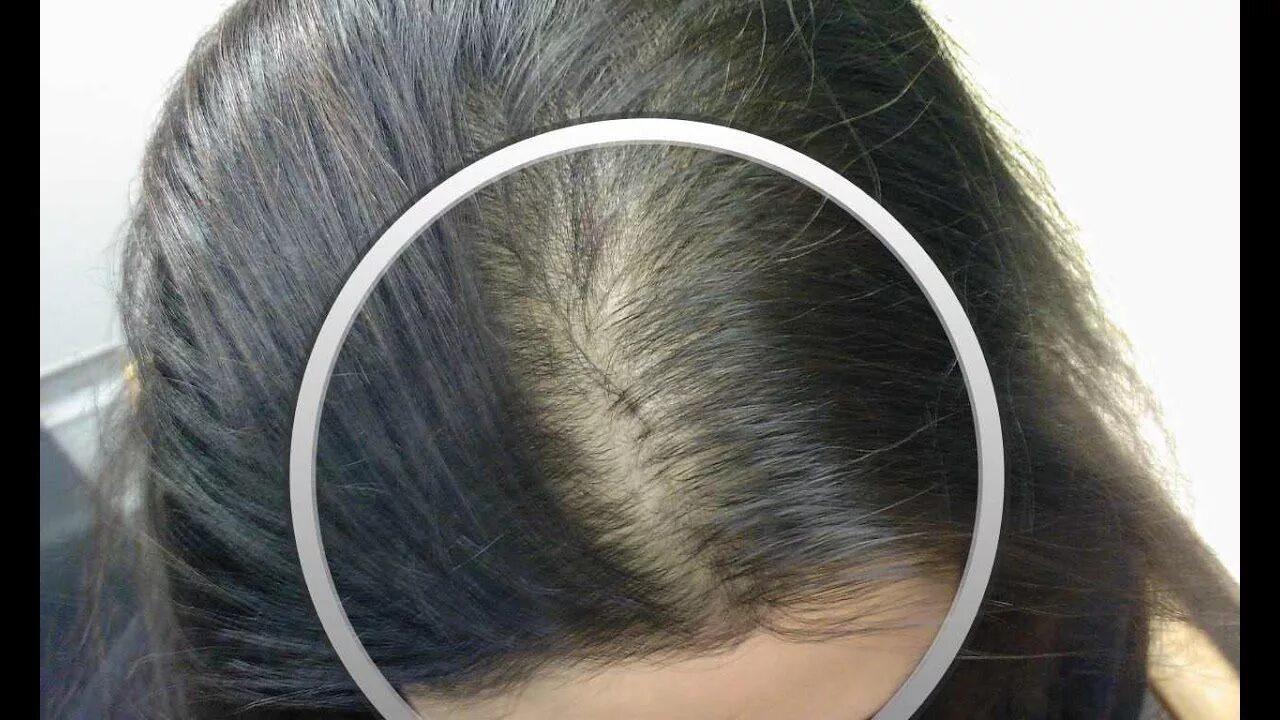 8 Ways to Balance pH in Hair Naturally - wikiHow Natural hair styles, Hair resto