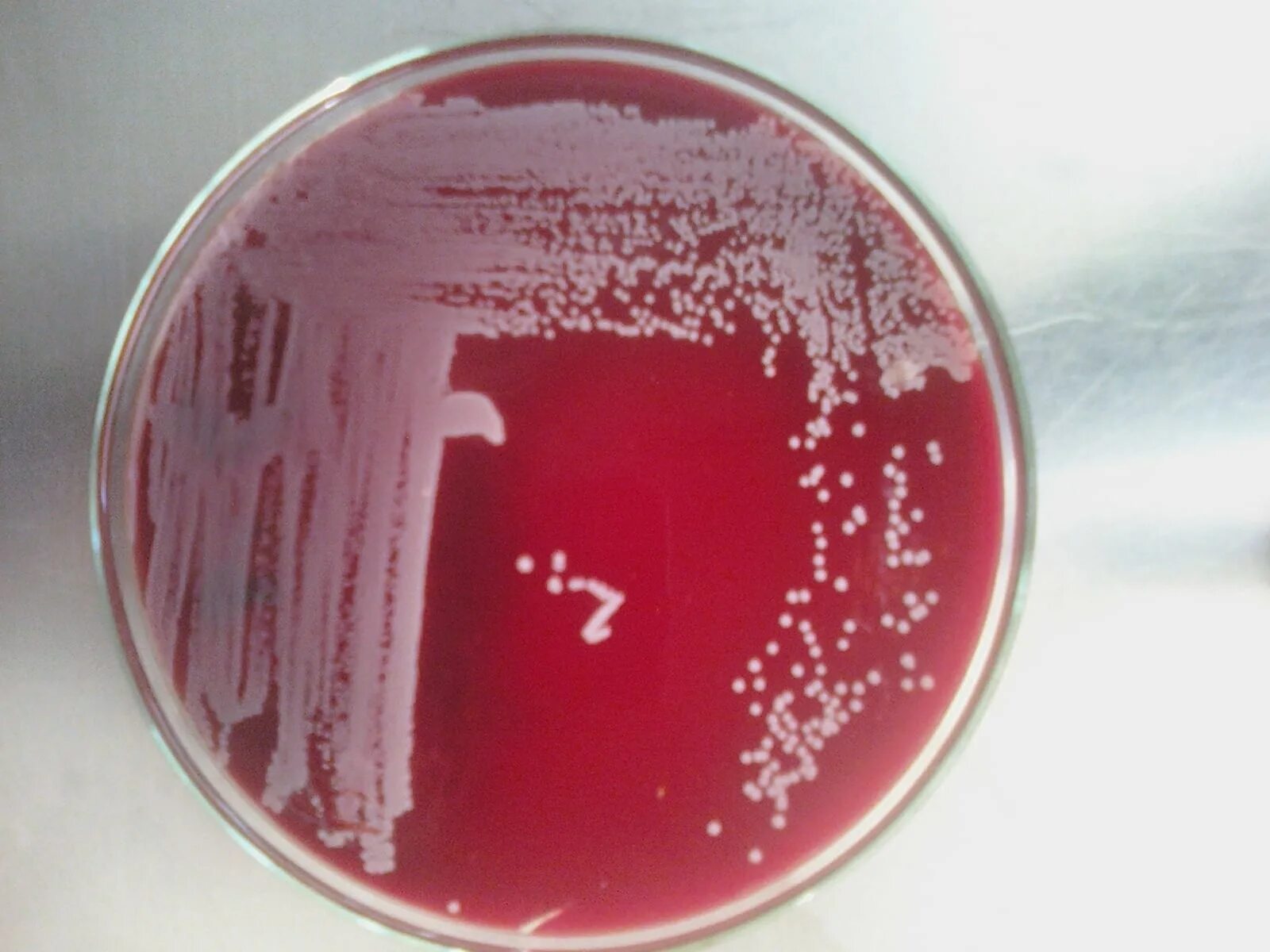 Кишечная палочка в моче причины лечение. Кишечная палочка Escherichia coli. Escherichia coli гемолитические антибиотики. Кишечная палочка посев.