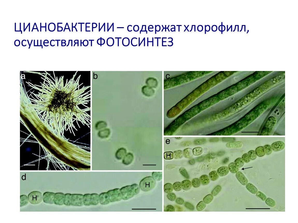 Цианобактерии фотосинтетики. Синезелёные водоросли цианобактерии. Цианобактерии хлорофилл. Фотосинтезируют цианобактерии. Группы организмов цианобактерии