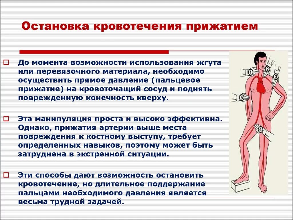 Остановка кровотечения. Остановкакровотеечния. Способы остановки кровотечения.