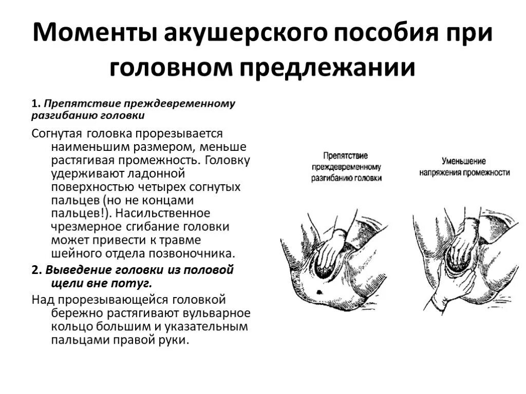 Самопроизвольные роды в затылочном предлежании. Акушерское пособие при головном предлежании. Акушерское пособие при головном предлежании алгоритм. Защита промежности при переднем виде затылочного предлежания. Прием родов акушерское пособие при головном предлежании.