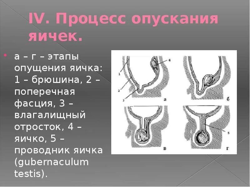 Опущение яичек у мальчиков. Влагалищный отросток брюшины. Опущение яичка в мошонку. Процесс опущения яичка. Яички в брюшную полость