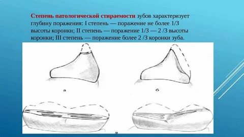 Вертикальная форма
