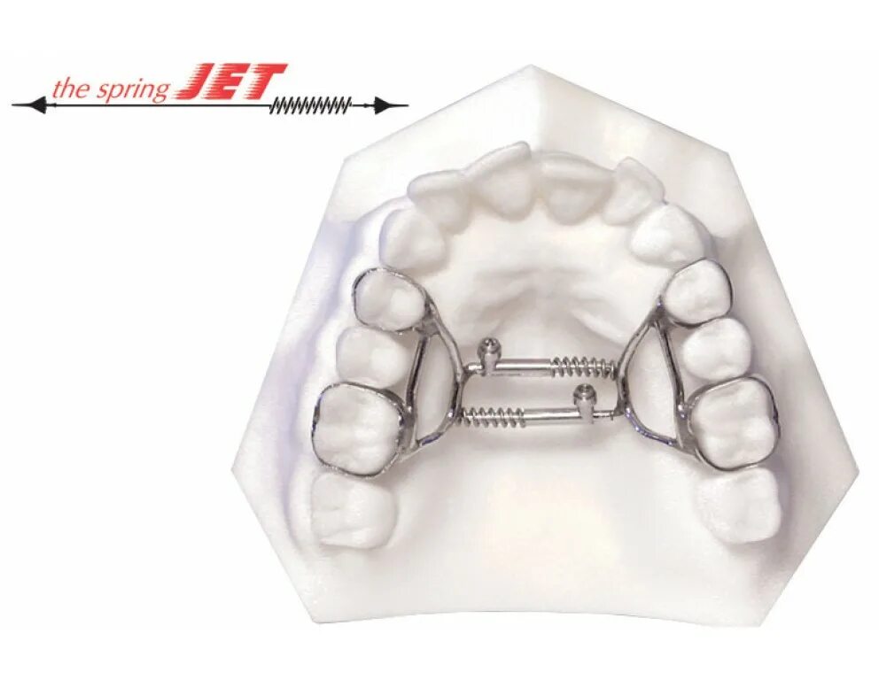 Spring Jet аппарат ортодонтия. Ортодонтический аппарат Марко Росса. Аппарат для расширения верхней челюсти аппарат Дерихсвайлера. Аппарат для дистализации моляров. Расширение челюсти цена