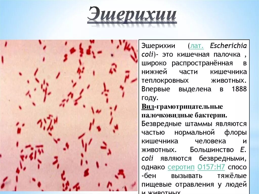 Coli sotwe. Klebsiella pneumoniae микроскопия. Эшерихия коли симптомы. Форма бактерии Escherichia coli. Грамотрицательные кишечные палочки.