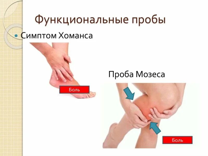 Симптом хоманса и мозеса. Симптом хоманса и мозеса. Симптом хоманса и мозеса. Симптомы хоманса, мозеса, левенберга. Симптом хоманса и мозеса.