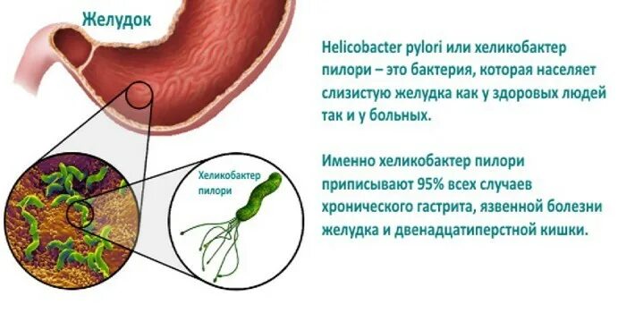 Хеликобактер язык. Язва желудка хеликобактер. Бактериальная инфекция хеликобактер пилори. Хеликобактер пилори язвенная болезнь.