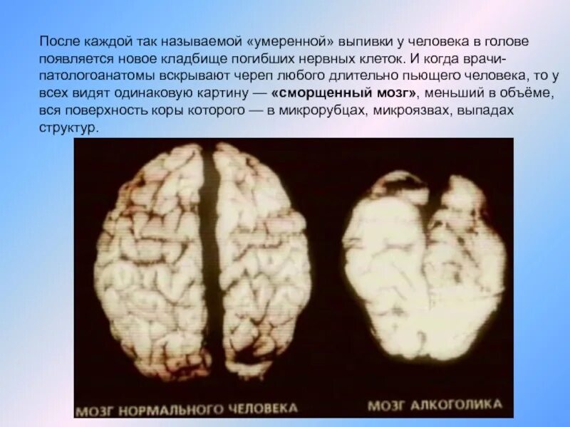 Мнестических процессов это. Локальные корковыми поражениями мозга. Органическое поражение головного мозга. Очаг белого размягчения в головном мозге. Первичные поражения головного мозга.