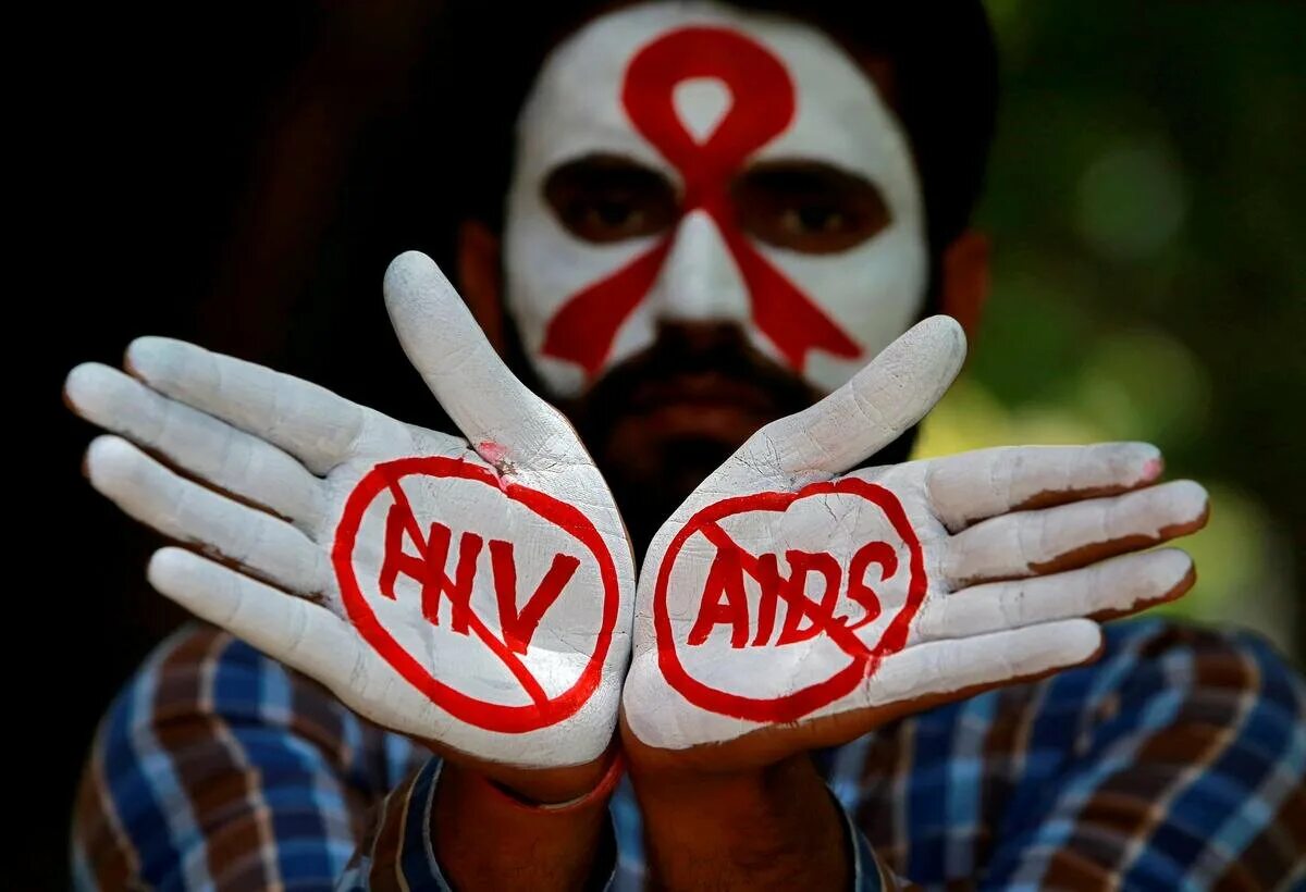 AIDS. СПИД. HIV AIDS. Ассоциации с ВИЧ.