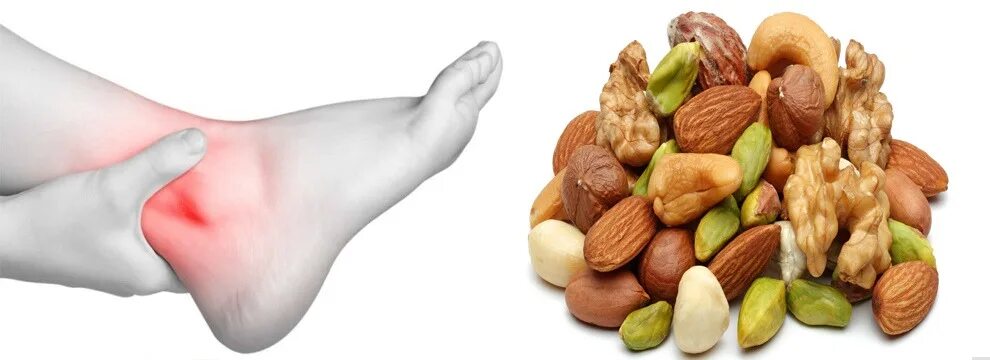 Какие орехи есть при подагре подагре