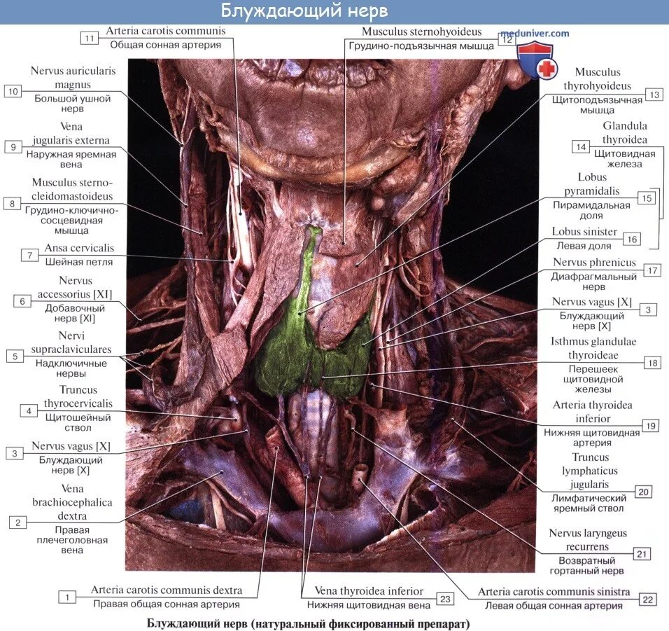 Левый блуждающий нерв. Блуждающий нерв nervus Vagus. Блуждающий нерв 1 Нейрон. Nervus Vagus топография. Возвратный нерв анатомия.